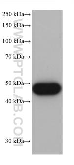 ALDH2 Antibody in Western Blot (WB)