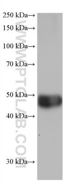 ALDH2 Antibody in Western Blot (WB)