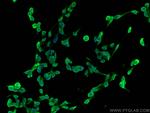 KLK8 Antibody in Immunocytochemistry (ICC/IF)