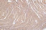 NDUFS1 Antibody in Immunohistochemistry (Paraffin) (IHC (P))