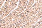 NDUFS1 Antibody in Immunohistochemistry (Paraffin) (IHC (P))