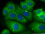 ABL1 Antibody in Immunocytochemistry (ICC/IF)