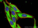 SNX17 Antibody in Immunocytochemistry (ICC/IF)