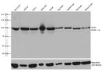 ZHX2 Antibody in Western Blot (WB)