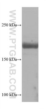 SCN5A Antibody in Western Blot (WB)