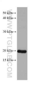 DHFR Antibody in Western Blot (WB)