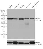 CRTAC1 Antibody in Western Blot (WB)