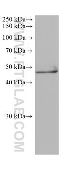 NEUROD2 Antibody in Western Blot (WB)