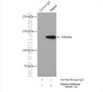 Raptor Antibody in Immunoprecipitation (IP)