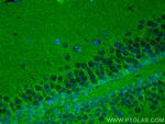 NRCAM Antibody in Immunohistochemistry (PFA fixed) (IHC (PFA))