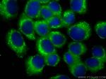 SNX3 Antibody in Immunocytochemistry (ICC/IF)