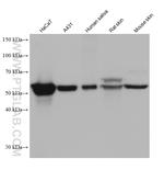 Cytokeratin 5/6 Antibody in Western Blot (WB)