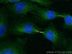 MICAL1 Antibody in Immunocytochemistry (ICC/IF)