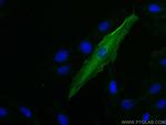 Cardiac Troponin T Antibody in Immunocytochemistry (ICC/IF)