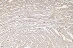 Cardiac Troponin T Antibody in Immunohistochemistry (Paraffin) (IHC (P))