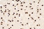 m5C Antibody in Immunohistochemistry (Paraffin) (IHC (P))