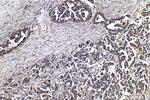 m7G Antibody in Immunohistochemistry (Paraffin) (IHC (P))