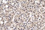 m7G Antibody in Immunohistochemistry (Paraffin) (IHC (P))