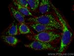 DLAT Antibody in Immunocytochemistry (ICC/IF)