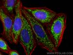 DLAT Antibody in Immunocytochemistry (ICC/IF)