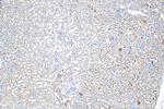 DLAT Antibody in Immunohistochemistry (Paraffin) (IHC (P))