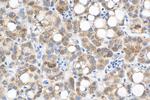 DLAT Antibody in Immunohistochemistry (Paraffin) (IHC (P))