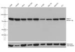 PNPT1 Antibody in Western Blot (WB)