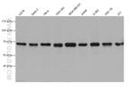 GTSE1 Antibody in Western Blot (WB)