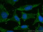 EXOSC10 Antibody in Immunocytochemistry (ICC/IF)