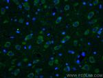 Ataxin 2 Antibody in Immunohistochemistry (PFA fixed) (IHC (PFA))