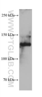 COL3A1 Antibody in Western Blot (WB)