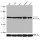 MTHFD1L Antibody in Western Blot (WB)