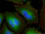 SH3GLB2 Antibody in Immunocytochemistry (ICC/IF)