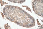 SH3GLB2 Antibody in Immunohistochemistry (Paraffin) (IHC (P))