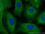 AKR1B10 Antibody in Immunocytochemistry (ICC/IF)