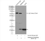 Histone H3 Antibody in Immunoprecipitation (IP)