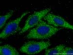 ATPAF2 Antibody in Immunocytochemistry (ICC/IF)