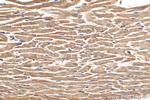 NDUFB7 Antibody in Immunohistochemistry (Paraffin) (IHC (P))