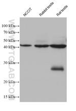 ARPM1 Antibody in Western Blot (WB)