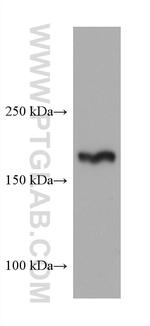 TSC2 Antibody in Western Blot (WB)