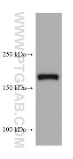 TSC2 Antibody in Western Blot (WB)