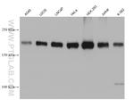 TSC2 Antibody in Western Blot (WB)