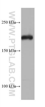 TSC2 Antibody in Western Blot (WB)