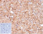 Synaptophysin Antibody in Immunohistochemistry (Paraffin) (IHC (P))