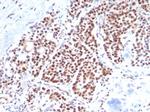 TBXT/T-box transcription factor T/Brachyury Antibody in Immunohistochemistry (Paraffin) (IHC (P))