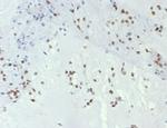 TBXT/T-box transcription factor T/Brachyury Antibody in Immunohistochemistry (Paraffin) (IHC (P))