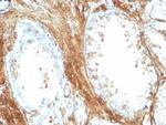 Transgelin (SM22-alpha) Antibody in Immunohistochemistry (Paraffin) (IHC (P))