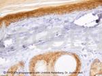 Desmoglein 1/2 Antibody in Immunohistochemistry (Paraffin) (IHC (P))