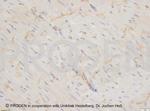 Desmoglein 1/2 Antibody in Immunohistochemistry (Paraffin) (IHC (P))