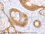 Desmoglein 1/2 Antibody in Immunohistochemistry (Paraffin) (IHC (P))